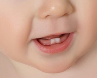 Doorkomende Tandjes: Tips & verzachting